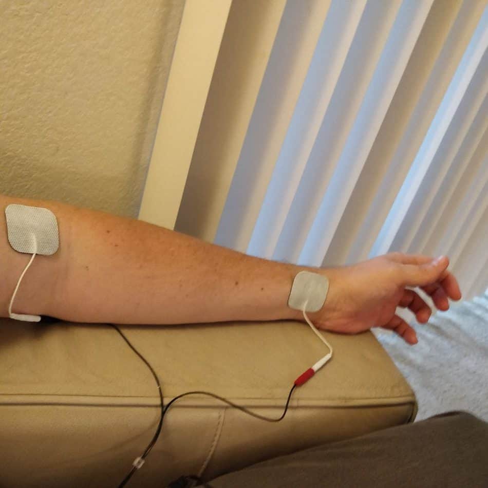 Eliminate Ulnar Nerve Pain Using Proven TENS Pad Placement Techniques ...