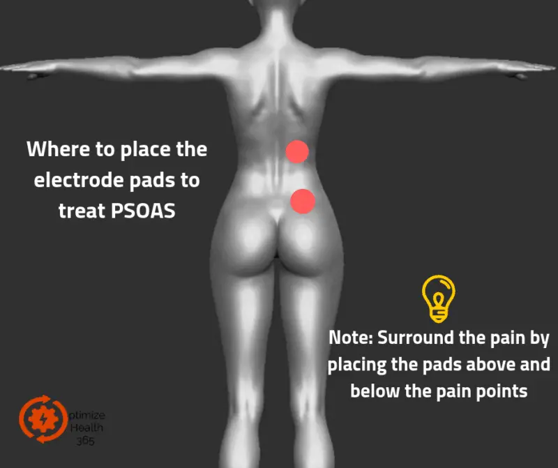 Where to place the electrode pads to treat PSOAS