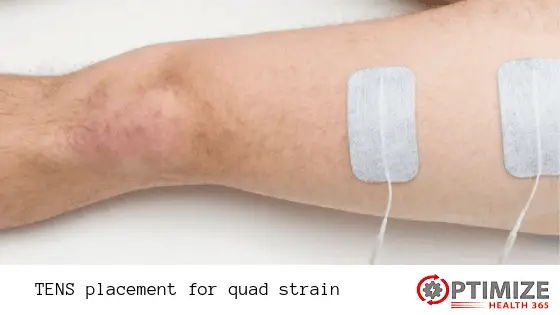 TENS placement for quad strain