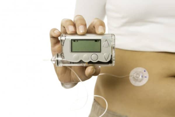 Can You Use a TENS Unit with an Insulin Pump?