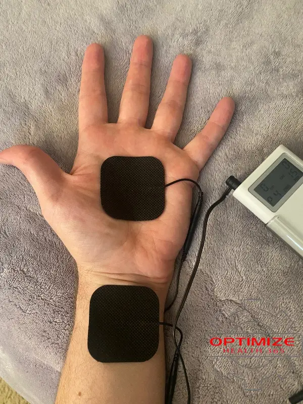 tens unit carpal tunnel placement