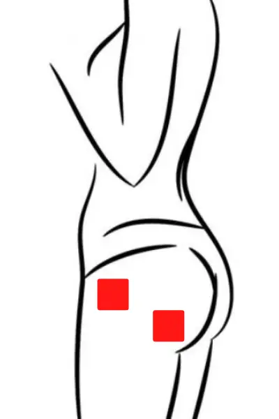 TENS Placement for hip pain
