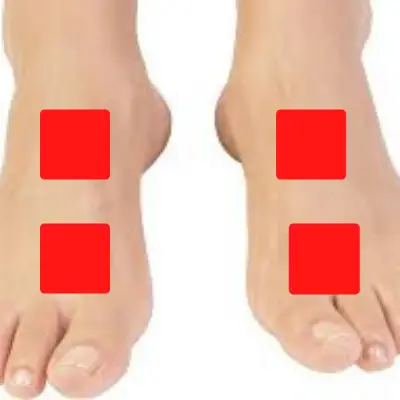 TENS Unit Placement for Foot Neuropathy